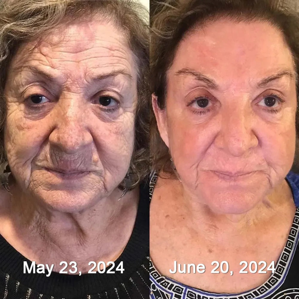 BeeTox® Crema Antiarrugas con Botox y Veneno de Abeja