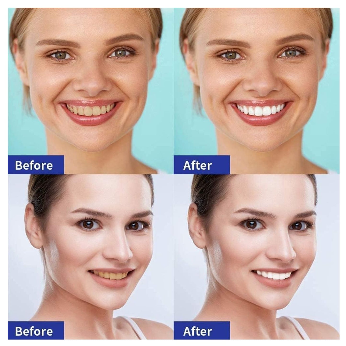 5D White® Tiras de Blanqueamiento Dental X14