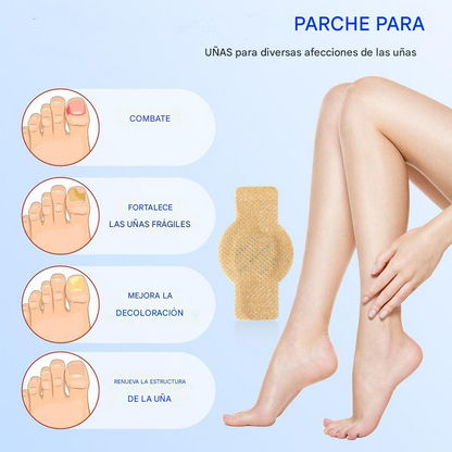 ClearNail® | PARCHES PARA UÑAS CON HONGOS ★ Tratamiento para uñas sanas