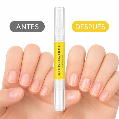 NailZen™ Aceite Para el Crecimiento de Uñas X2 pcs