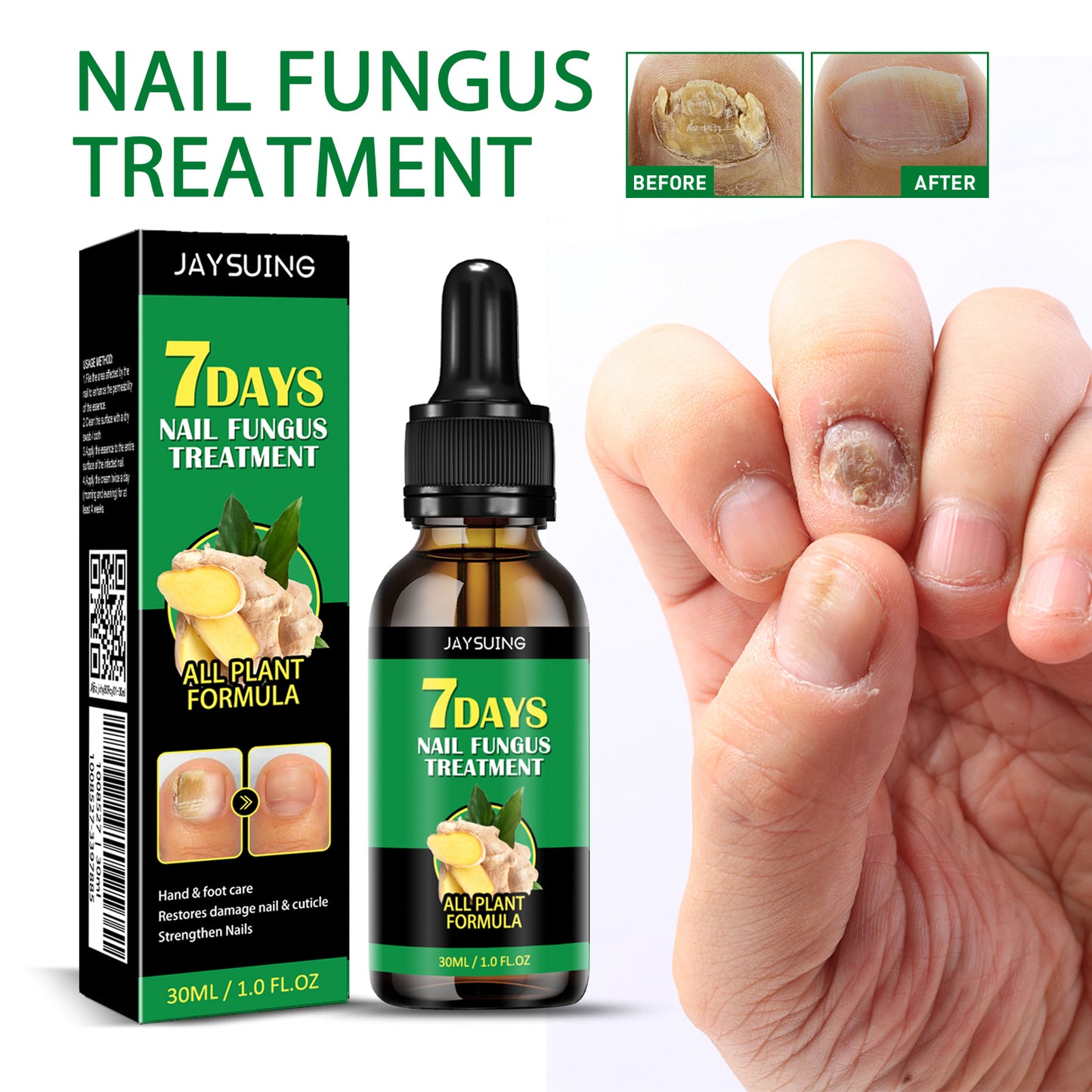 Fungi-Fix™ | TRATAMIENTO ANTIHONGOS PARA LAS UÑAS X2 PCS ★ Resultados garantizados en 7 días