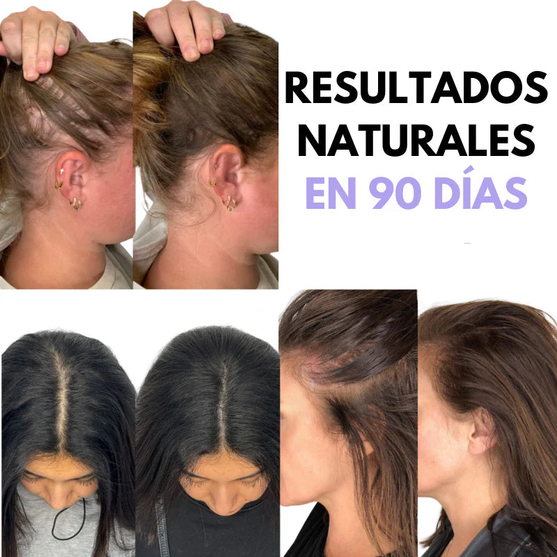 CEPILLO MASAJEADOR DE CUERO CABELLUDO 4 EN 1™ Estimula el crecimiento del cabello