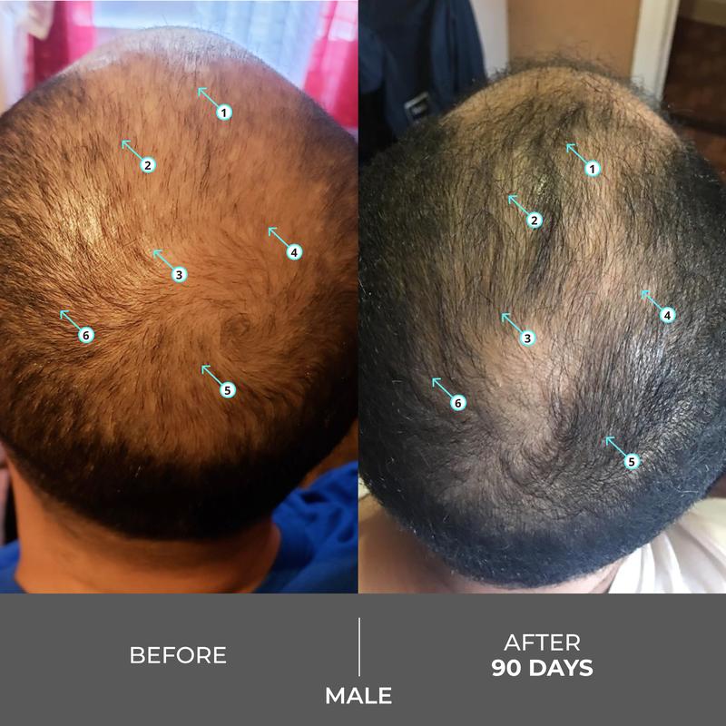 BioThick™ Shampoo Para El Crecimiento y Engrosamiento del Cabello
