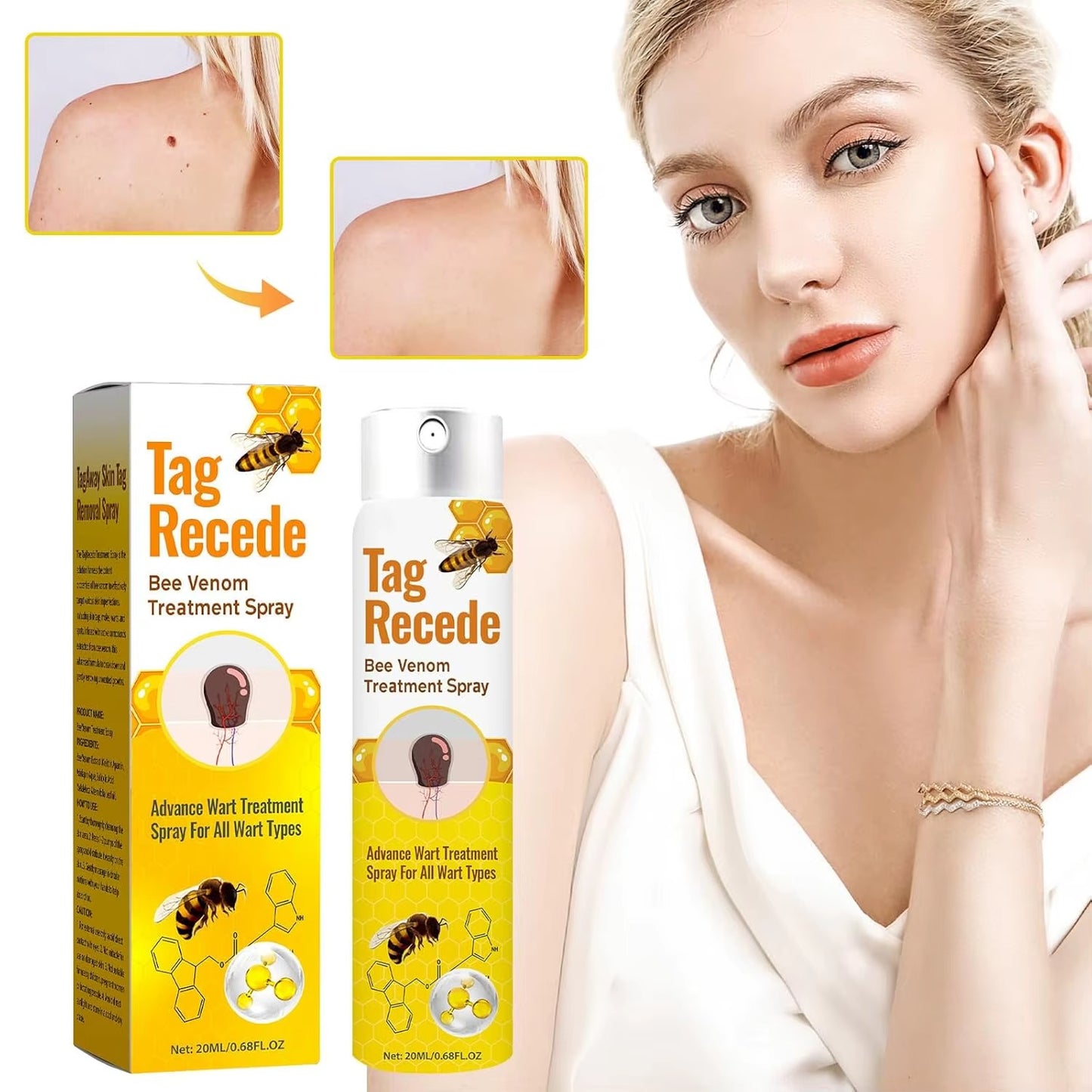 BeeSkin™ Eliminador de Verrugas