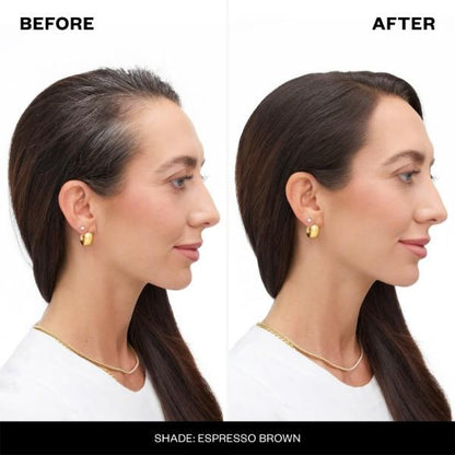 RootFix™ Spray de Retoque de Raíz y Cuero Cabelludo