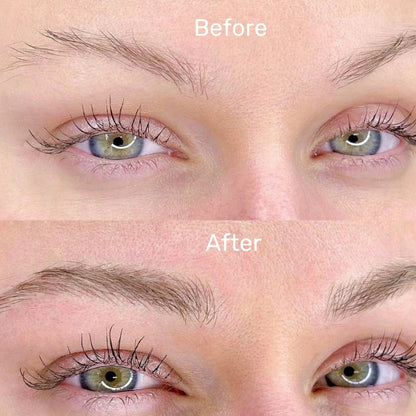 DermaRoller® Rodillo Con Micro-Agujas Para el Crecimiento de Vello