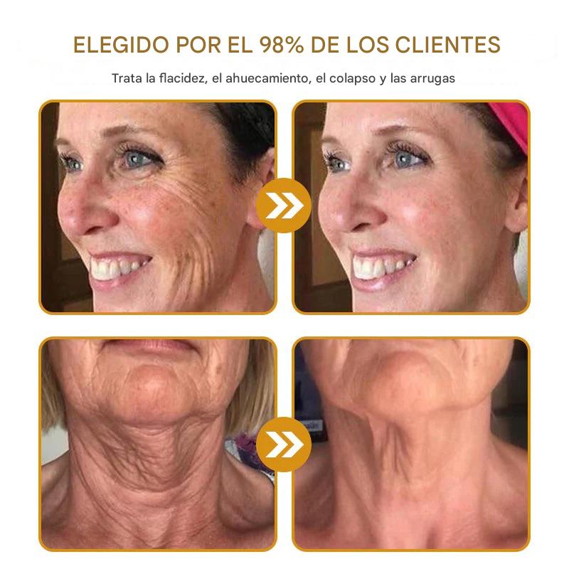 BeeTox® Crema Antiarrugas con Botox y Veneno de Abeja