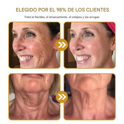 BeeTox® Crema Antiarrugas con Botox y Veneno de Abeja
