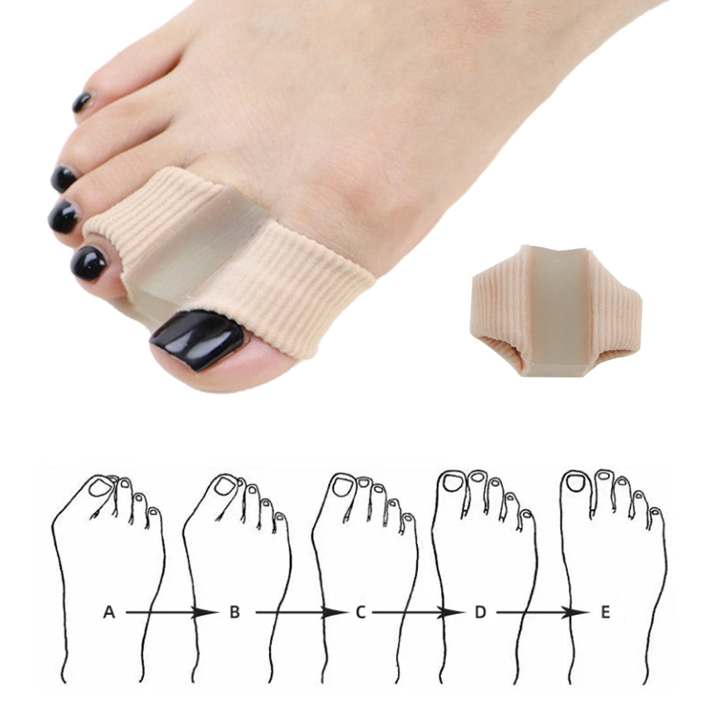 FootEase® Corrector de Juanetes de Silicona X2