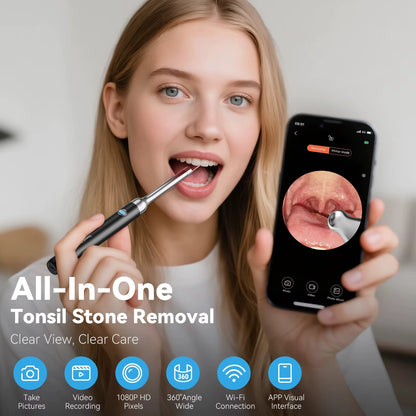 CleanLens™ Kit Limpiador de Cálculos Amigdalinos
