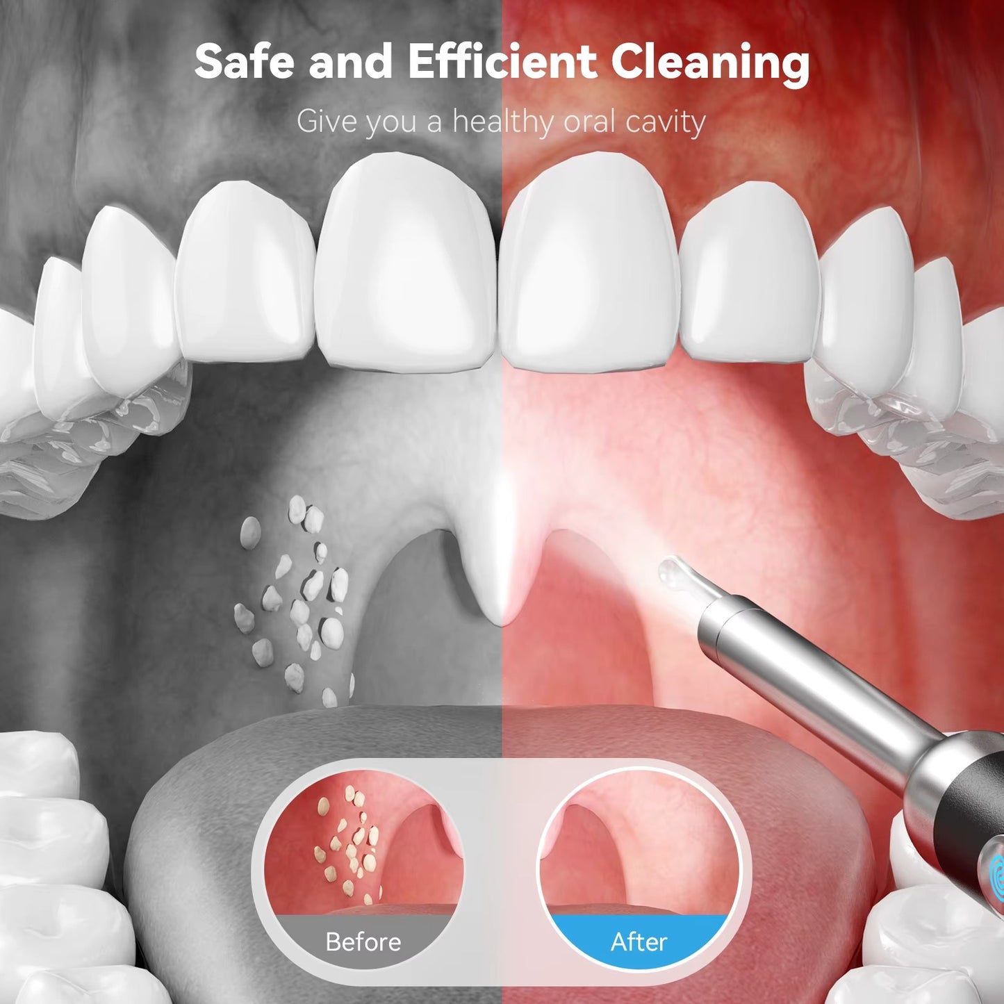 CleanLens™ Kit Limpiador de Cálculos Amigdalinos
