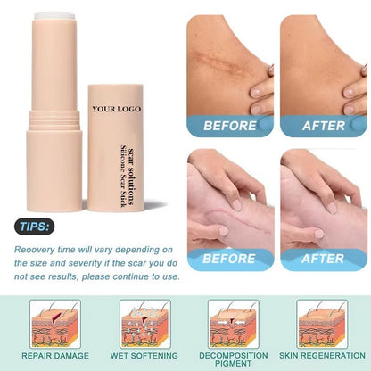 ScarErase™ Barra de Silicona Para Cicatrices y Estrías