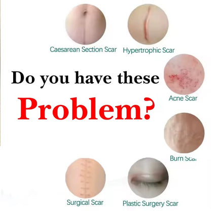 ScarErase™ Barra de Silicona Para Cicatrices y Estrías