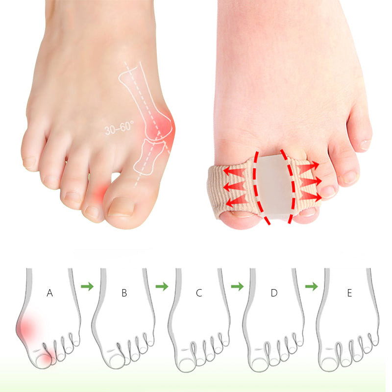 FootEase® Corrector de Juanetes de Silicona X2