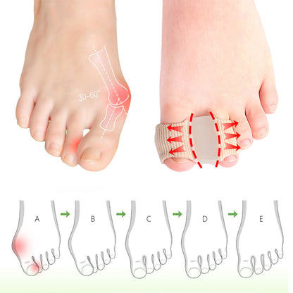 FootEase® Corrector de Juanetes de Silicona X2