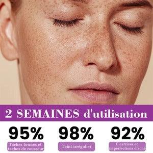 Radiant Skin PRO® | SÉRUM DESPIGMENTADOR ANTIMANCHAS ★ Corrector de Manchas Oscuras