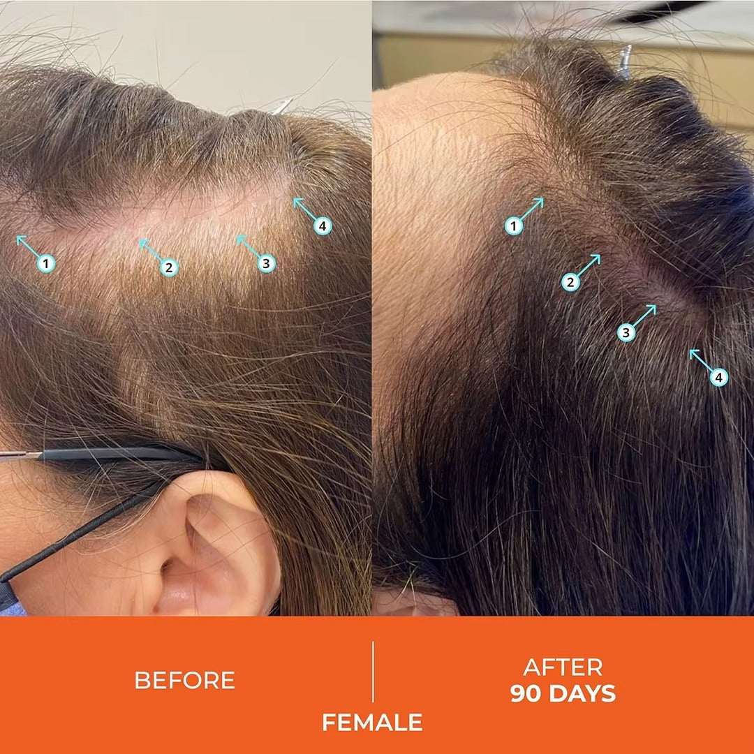 BioThick™ Shampoo Para El Crecimiento y Engrosamiento del Cabello